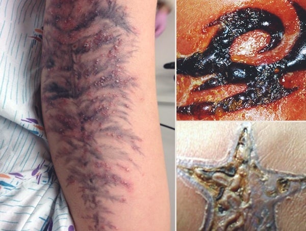 Tattoo Infection 101 - How Do You Know If Your New Ink Is ...