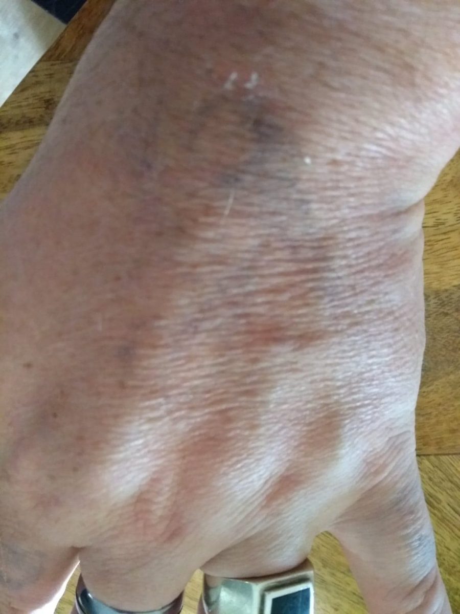 Hand Tattoo 1 week