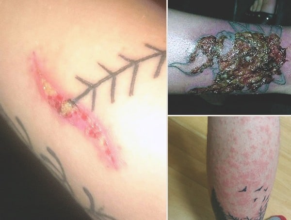 Warning Signs Of Tattoo Infection
